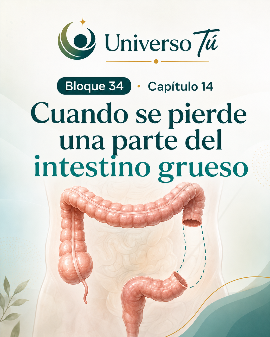 Portada del capítulo 14, Cuando se pierde una parte del intestino grueso, del bloque 34 de Universo Tú sobre el intestino grueso