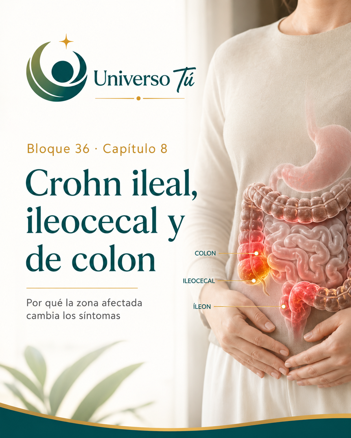 Portada del capítulo 8, Crohn ileal, ileocecal y de colon: por qué la zona afectada cambia los síntomas, del bloque 36 de Universo Tú sobre la enfermedad de Crohn