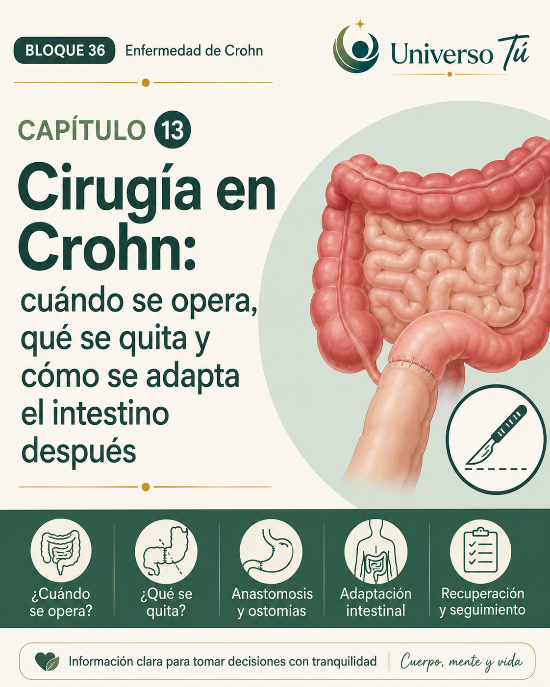Portada del capítulo 13, Cirugía en Crohn: cuándo se opera, qué se quita y cómo se adapta el intestino después, del bloque 36 de Universo Tú sobre la enfermedad de Crohn